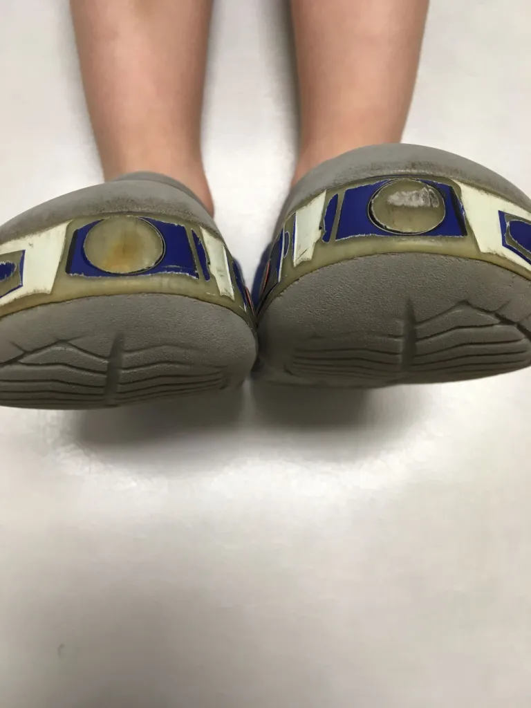 Leg Length Check